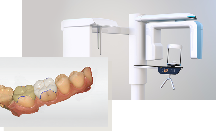 「根拠ある診断」を行うためのデジタル設備による精密検査