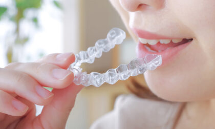 4.マウスピース（ナイトガード）の作製