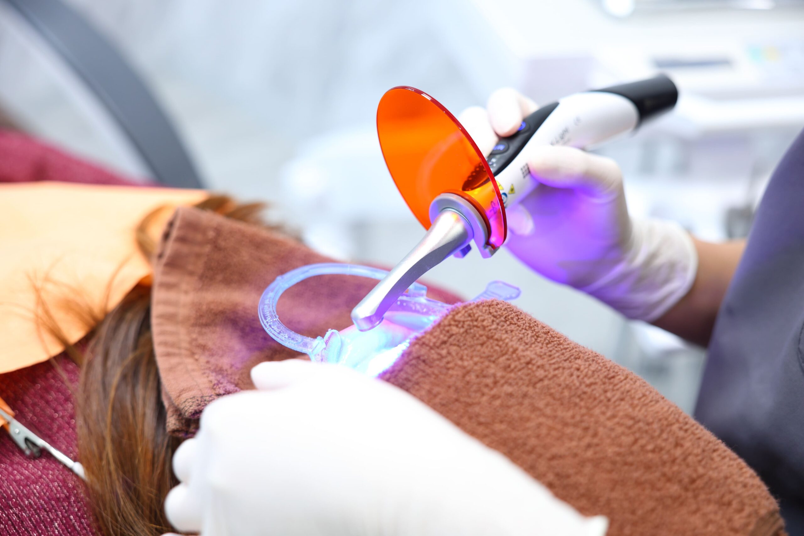 オフィスホワイトニング