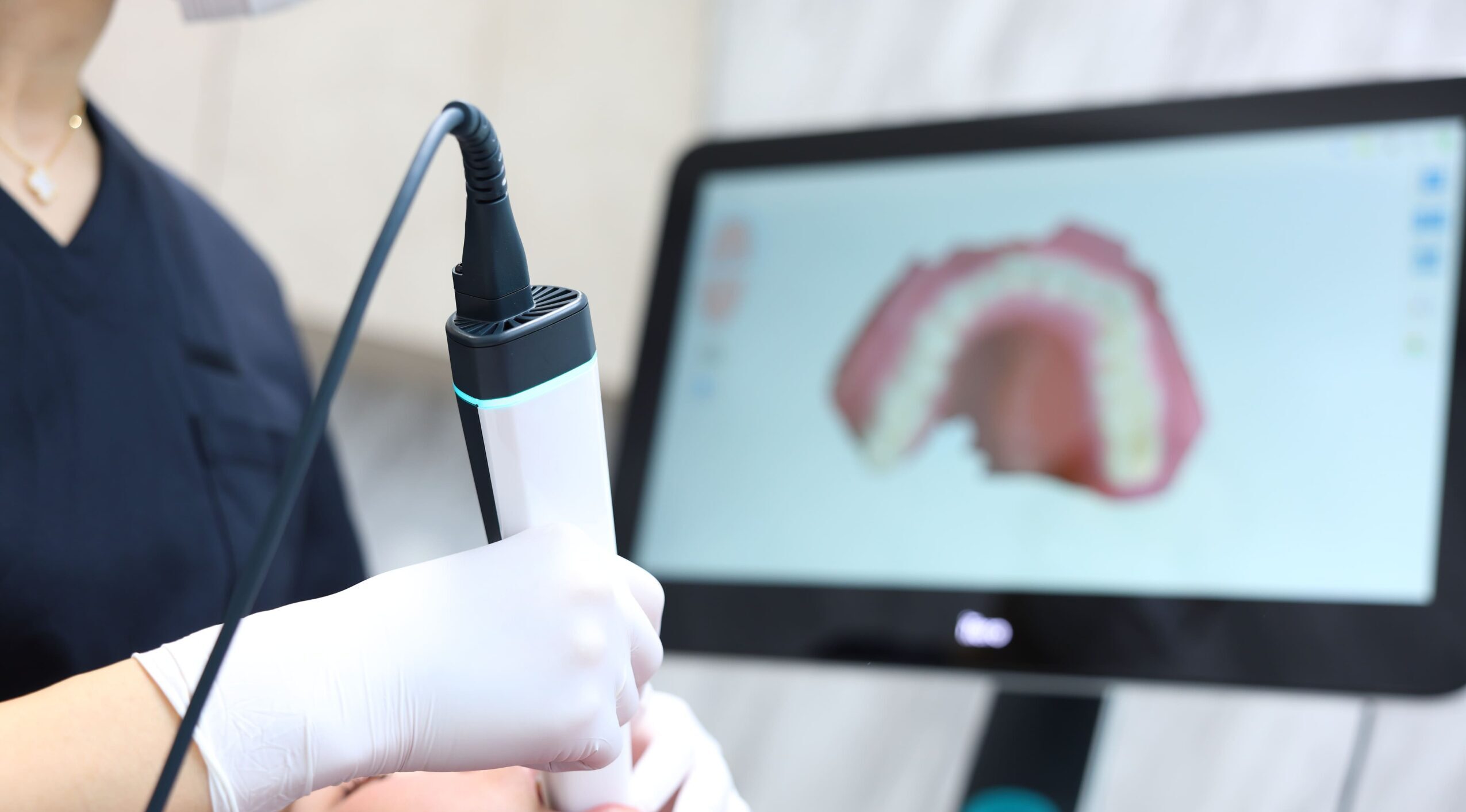 快適な矯正治療に欠かせない口腔内スキャナー「アイテロ」