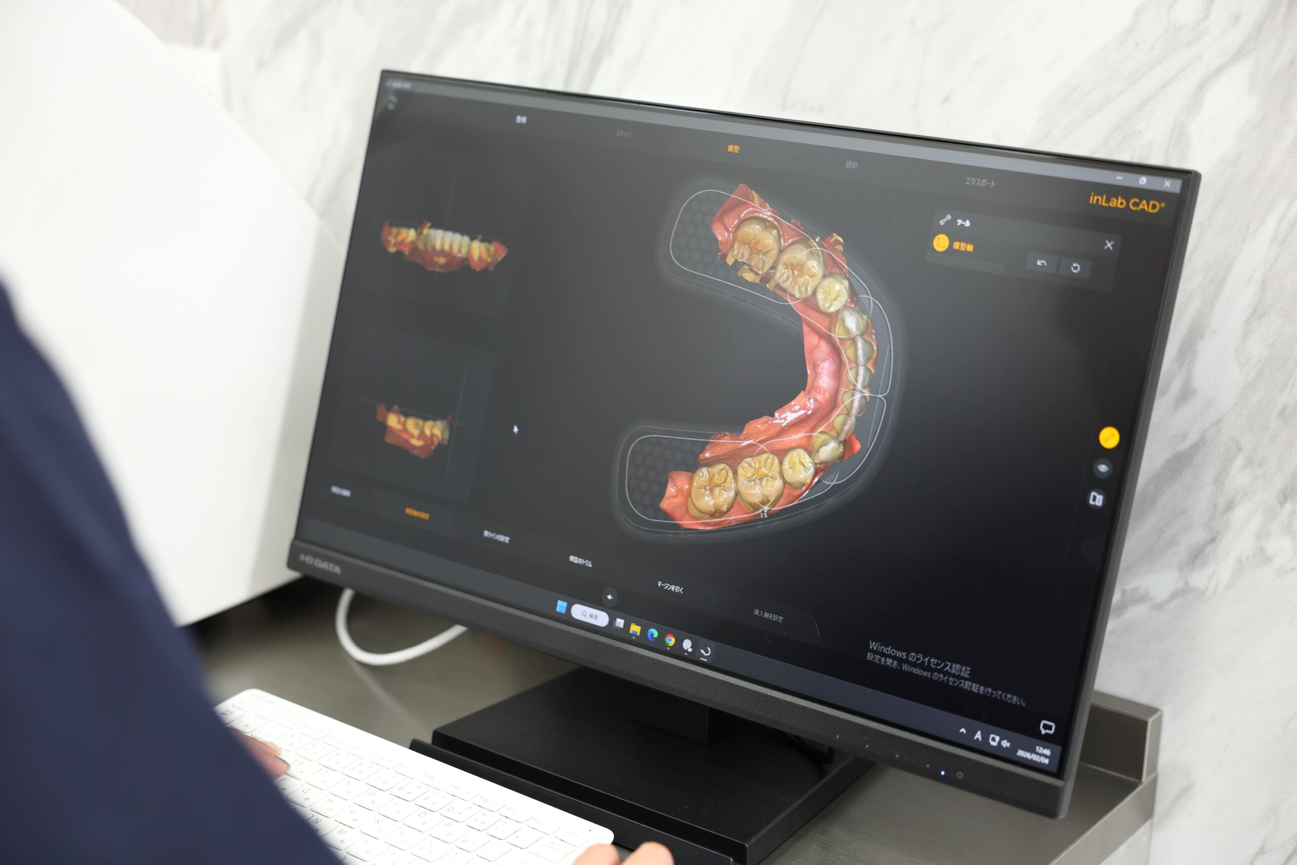 院内技工士が在籍